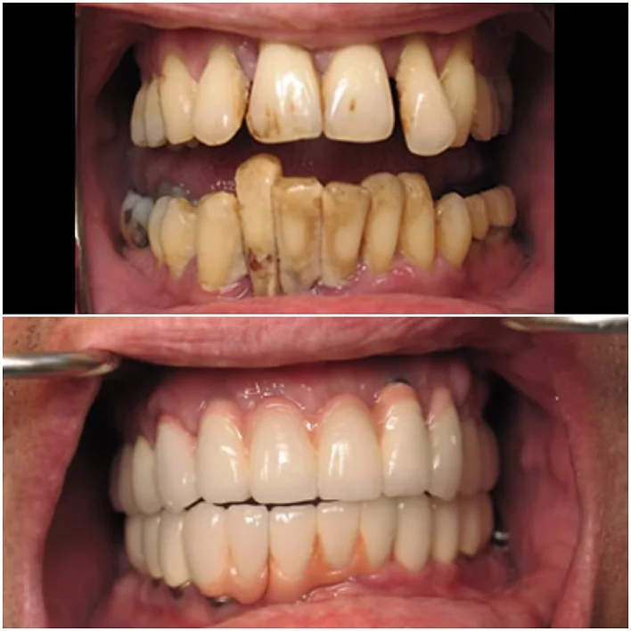 Before After Gallery Sculpted Smiles Before After Gallery Sculpted Smiles